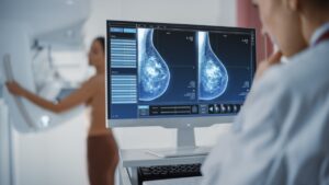 Technician looking at the x-rays of a woman's chest during a mammogram